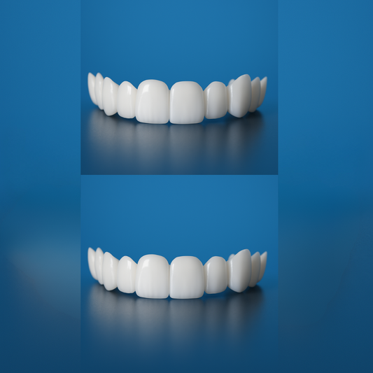 Lonryd SmileFlex™
